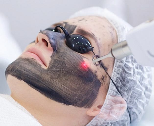 تفاوت پیلینگ هالیوودی و شیمیایی